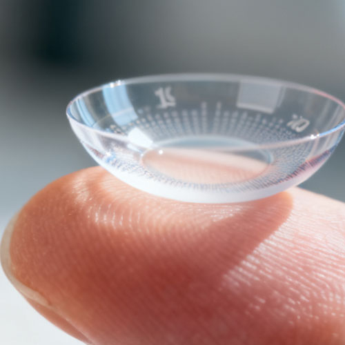 Lentes de ortoqueratología